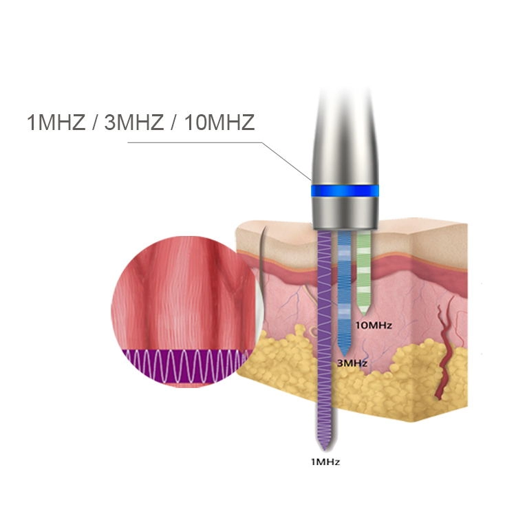 LDM Noblesse 10 МГц Ультразвуковая терапия 3 в 1 Ультразвуковое средство для удаления морщин Красота Устройство для похудения Инструмент для ухода за лицом