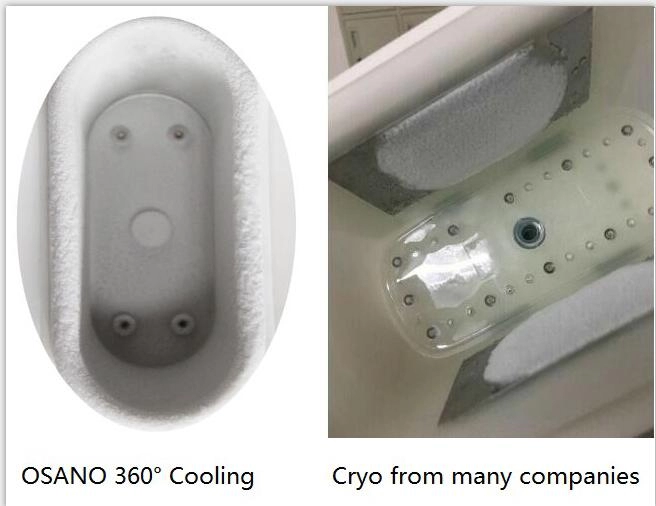 Портативная двойная потеря веса Cryo 360° ручки уменьшая оборудование красотки машины криотерапии